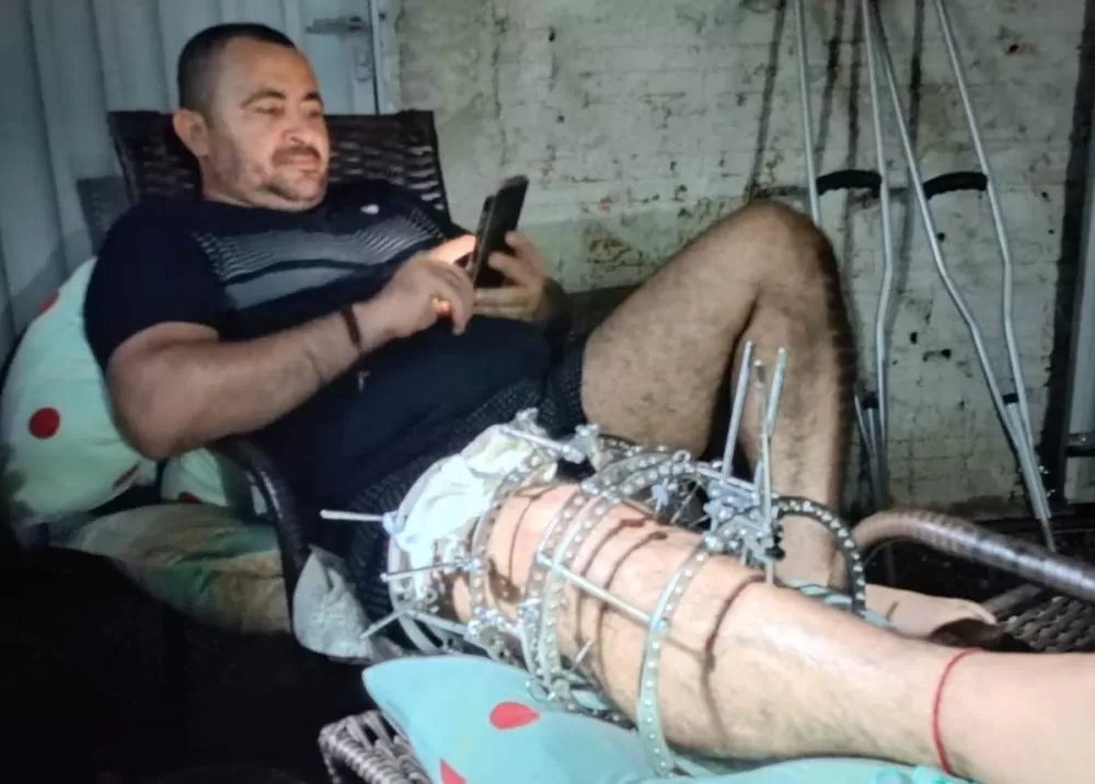 Hospital Regional de Paraíso ultrapassa 800 cirurgias ortopédicas em 2024